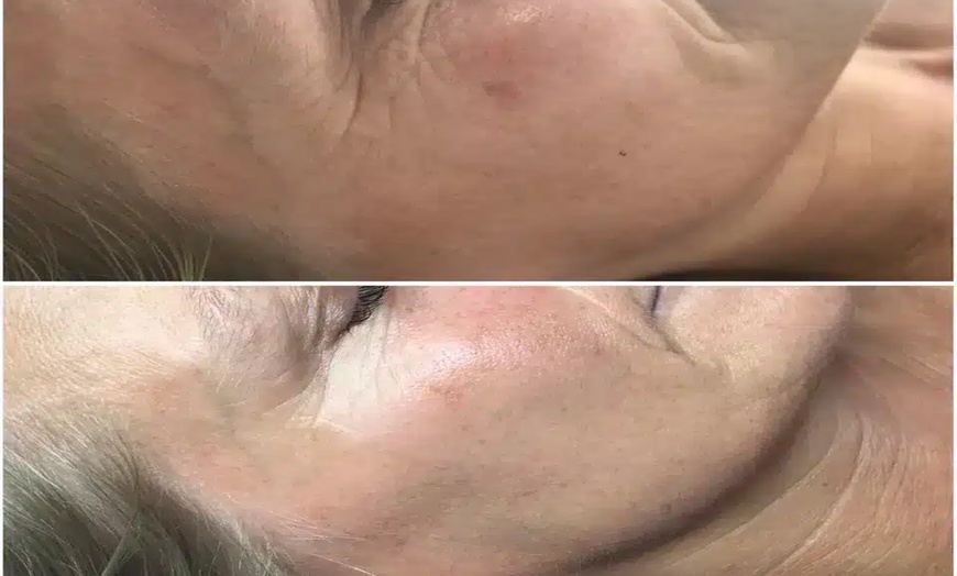 Image 2: Achieve Radiance with 6, 10, or 20 Dermalux MD Triwave LED Therapy 