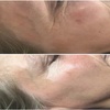 Image 2: Achieve Radiance with 6, 10, or 20 Dermalux MD Triwave LED Therapy 