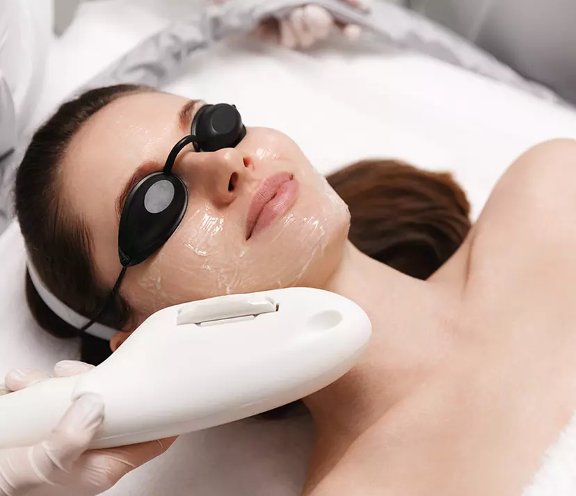 Up to 77% Off on IPL-Intense Pulse Light Therapy at ST Beauty Spa - Primary Image