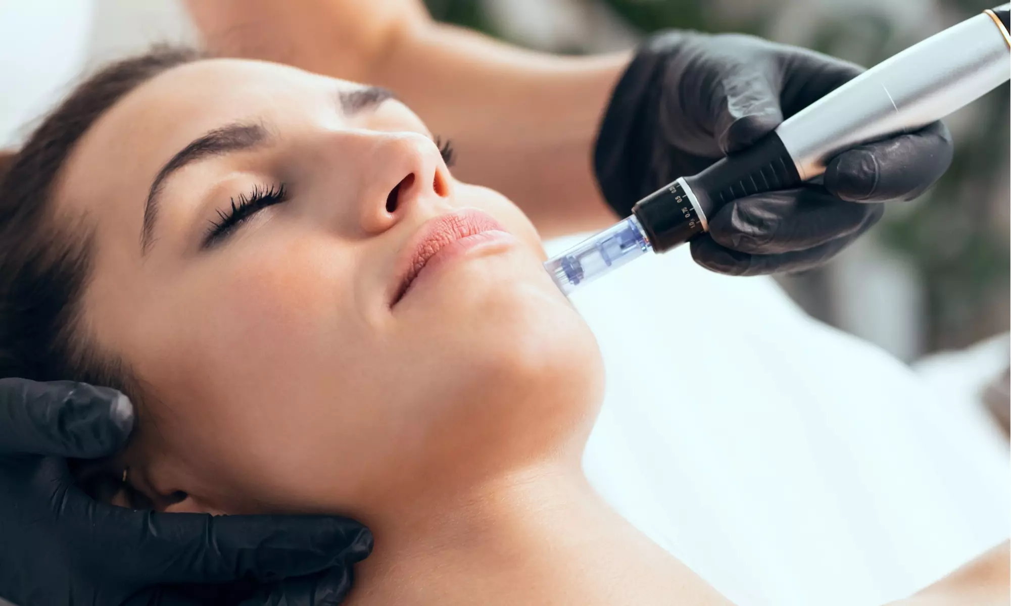 Up to 50% Off on Micro-Needling at Skinethicnyc - Primary Image
