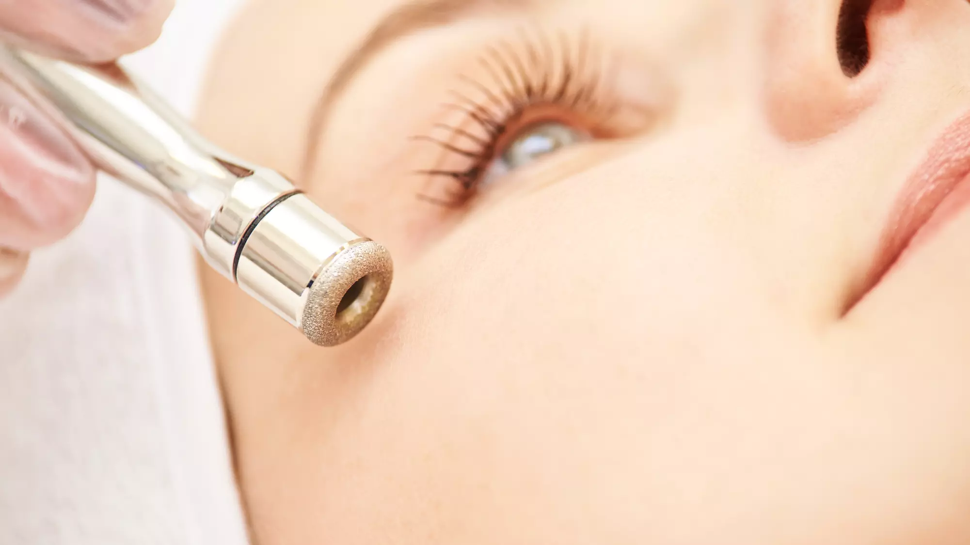 Up to 34% Off on Microdermabrasion at Modern Skin - Primary Image