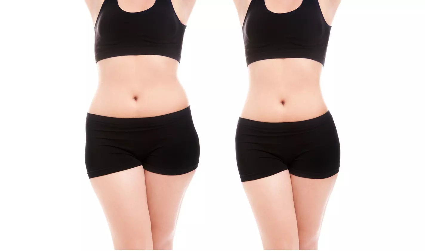Up to 60% Off on Ultrasonic Fat Reduction at Refined Physique - Primary Image