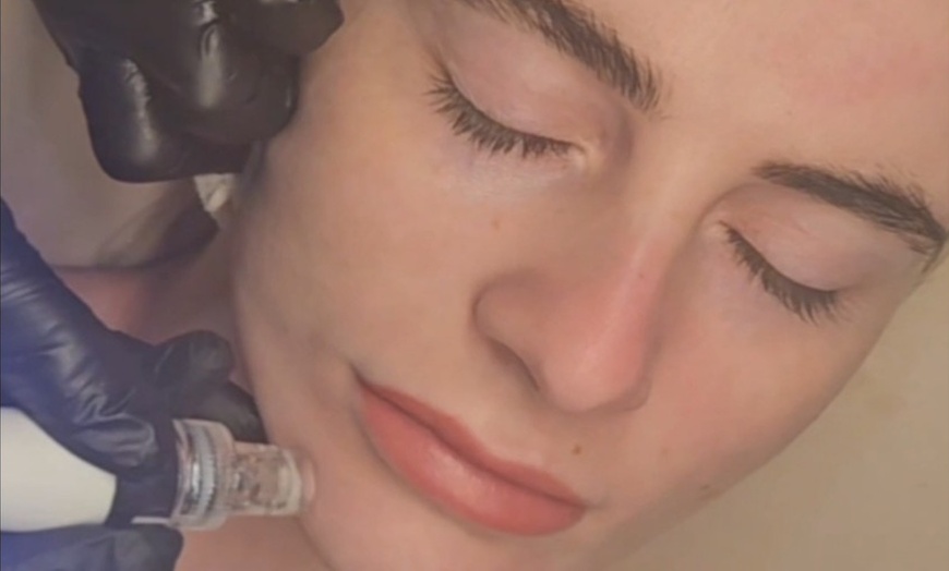 Image 1: Experience oxygen facials with LED light therapy session