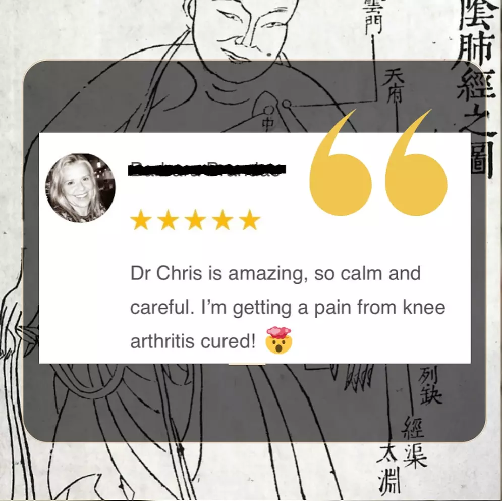 Experience Acupuncture with a Single Session