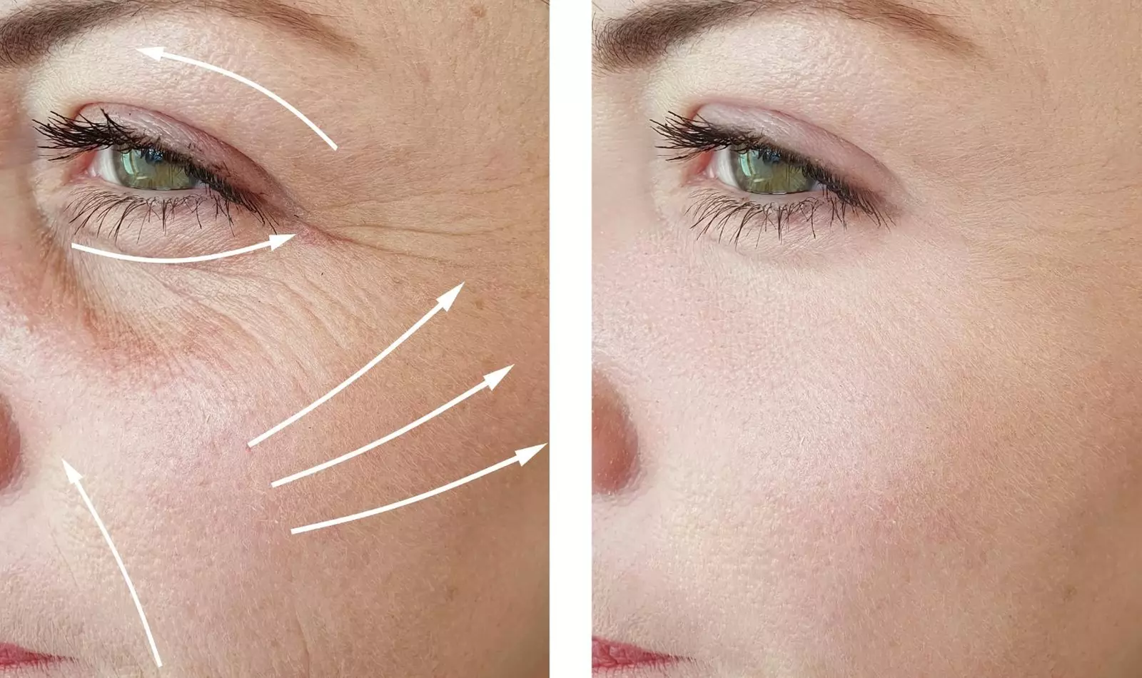 Up to 77% Off on Deep Pore cleasing Microdermabrasion
