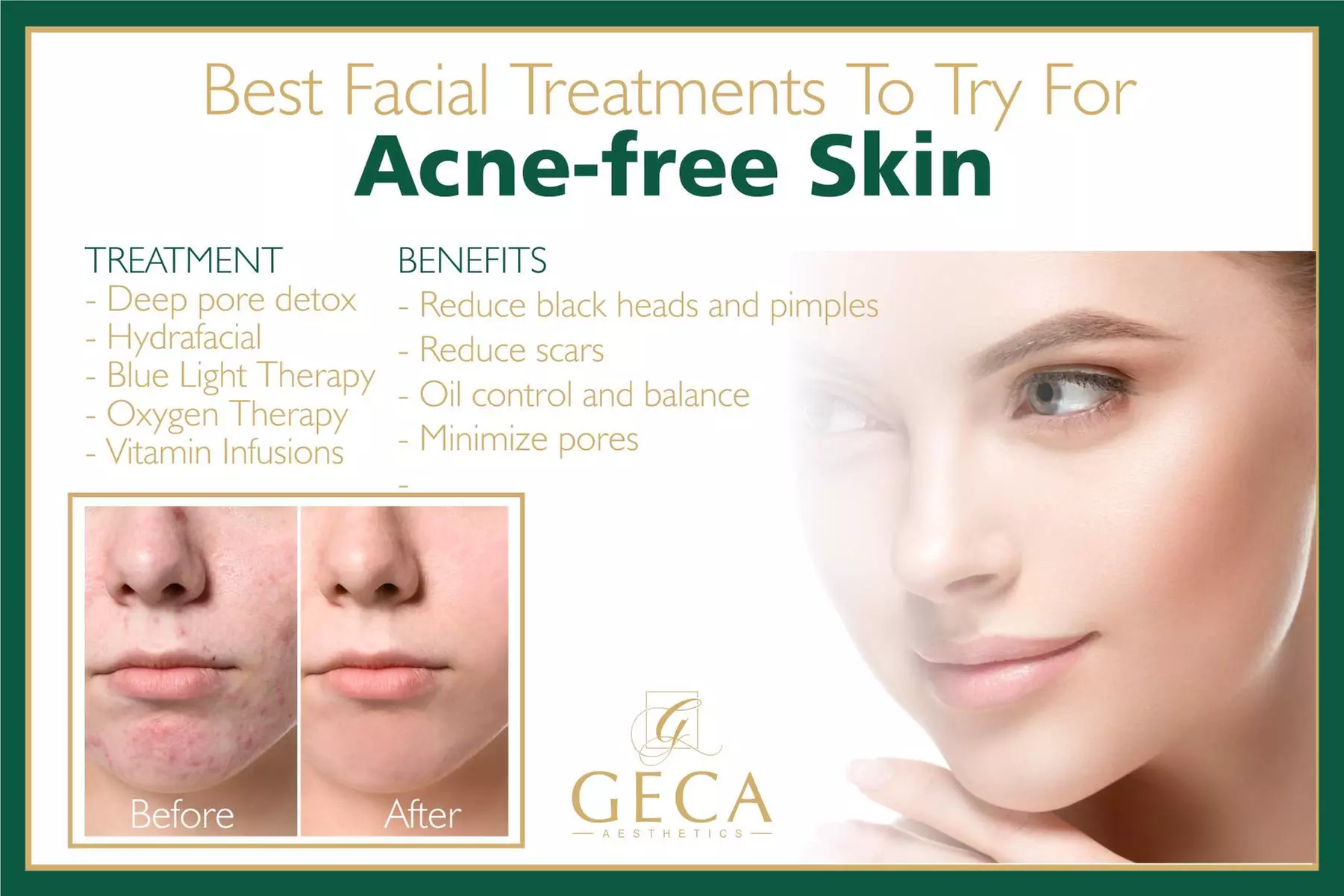 Up to 33% Off on Facial - Skin Lightening at Geca Aesthetics - Primary Image