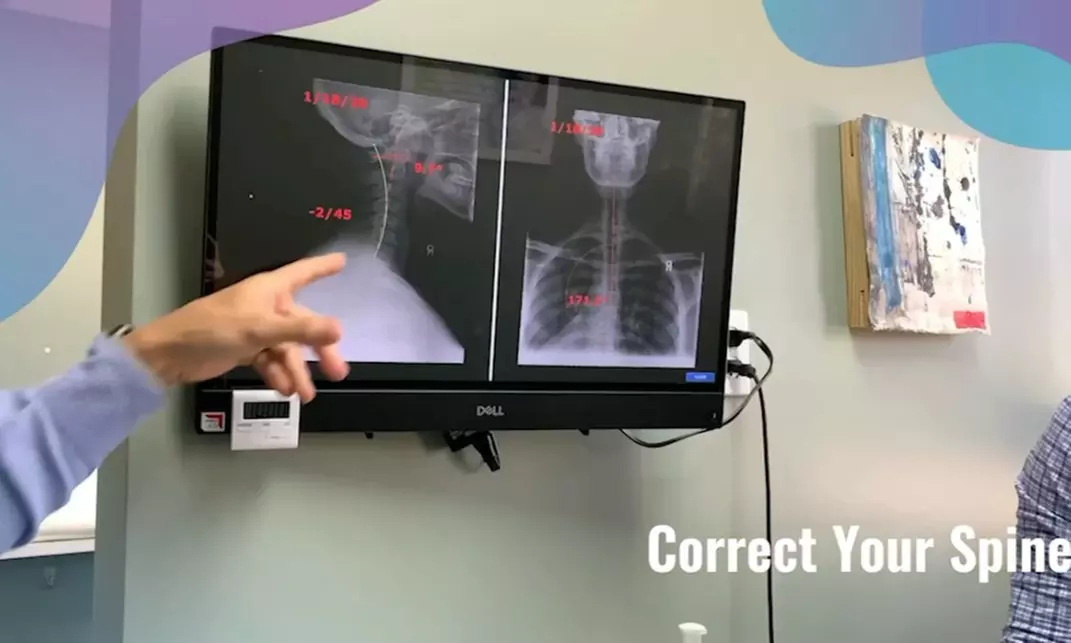 Discover Dr McNabb Boca Chiro's Advanced Decompression Therapy and More, with Savings up to 35% - Second Medium