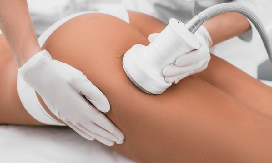 Image 2: Enhance Skin Tightening with Radio Frequency & Microneedle