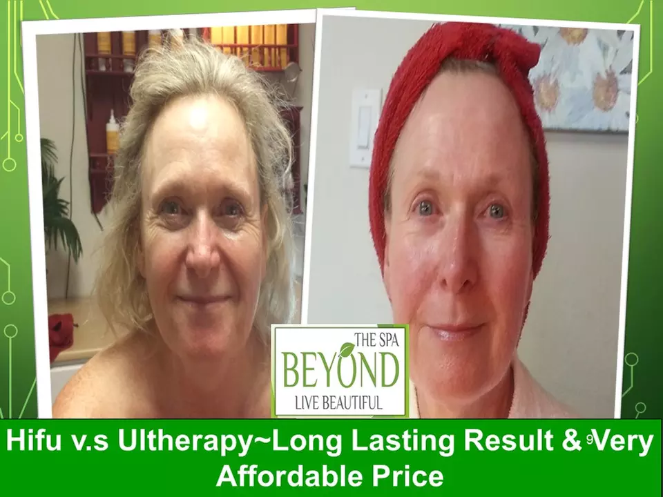 Lymphatic Drainage Massage with Hifu Options for Face and Body