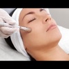 Image 1: Up to 40% Off on Microdermabrasion at Karina’s Beauty Spa, LLC