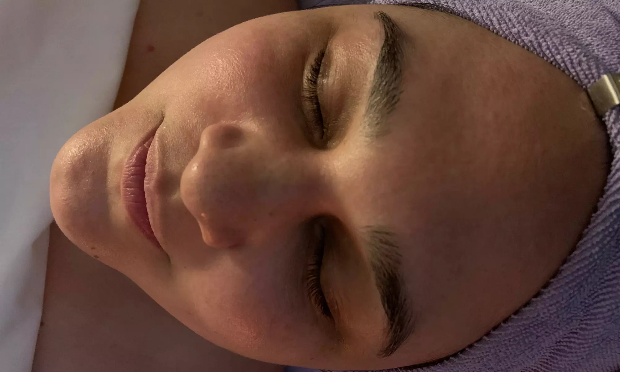 Up to 47% Off on Microdermabrasion at Aesthetic Alchemy - Second Medium