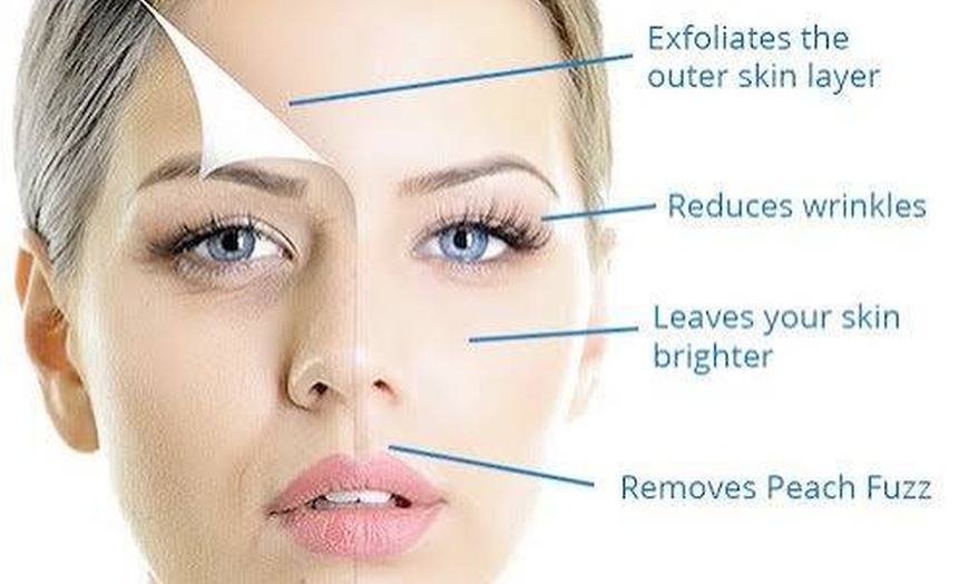 Image 2: Revitalize Your Skin with Dermaplaning and LED Treatment