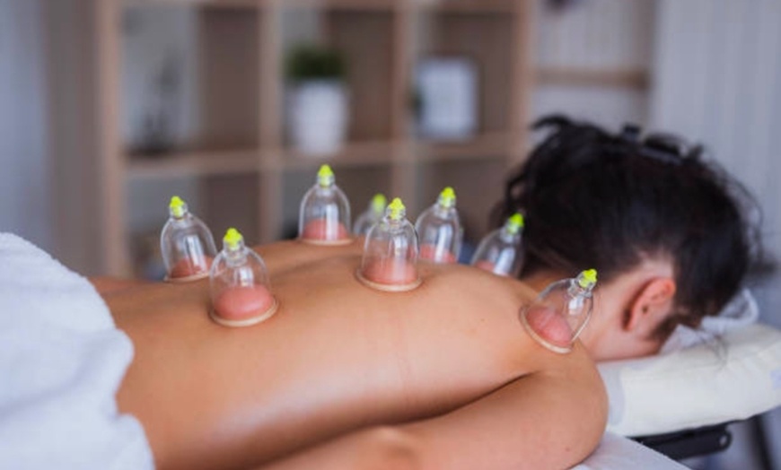 Image 1: Revitalize Your Body: One Cupping Session with Consultation