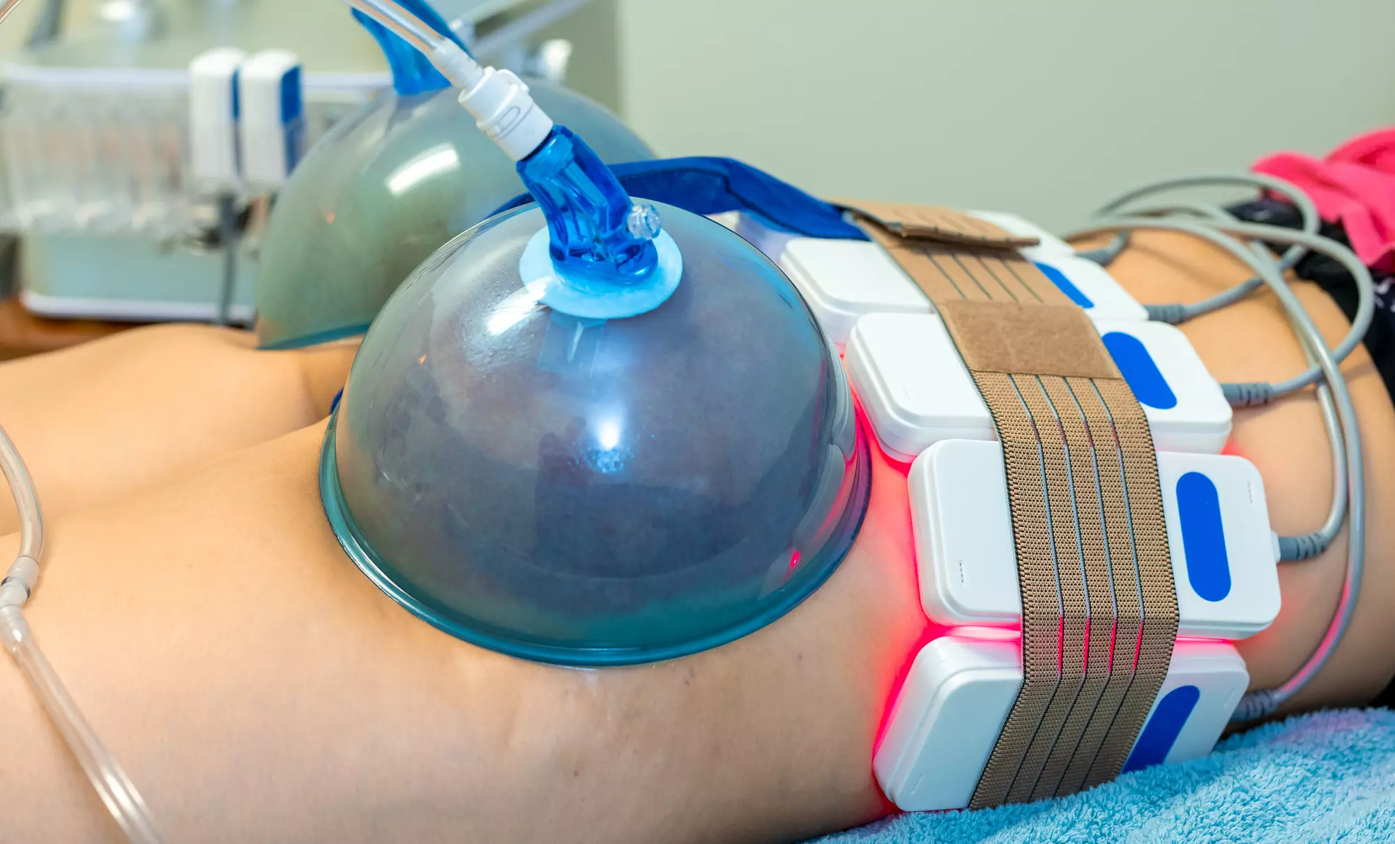 Up to 30% Off on Butt Lift - Non-Surgical  at Musa Body Sculpting - Primary Image