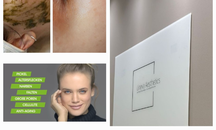 Image 1: 50% Rabatt auf Gesichtsbehandlung bei Lineva Aesthetics