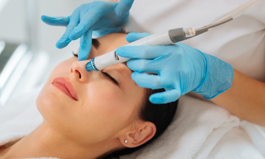 Image 1: Microneedling- oder Aqua-Facial-Behandlung für das Gesicht