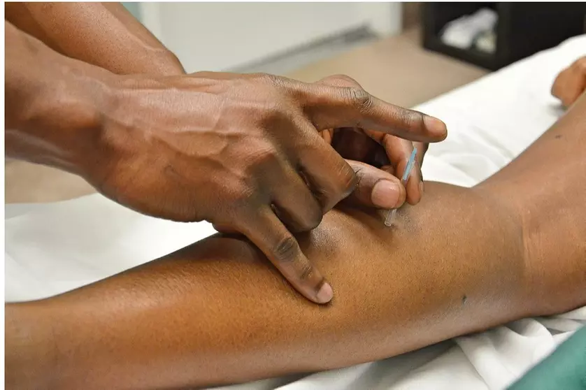 Up to 56% Off on Acupuncture at Everyday Acupuncture