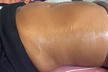Up to 50% Off on Lipo - Non-Invasive Laser-iLipo at Lashes and Lasers - Second Medium