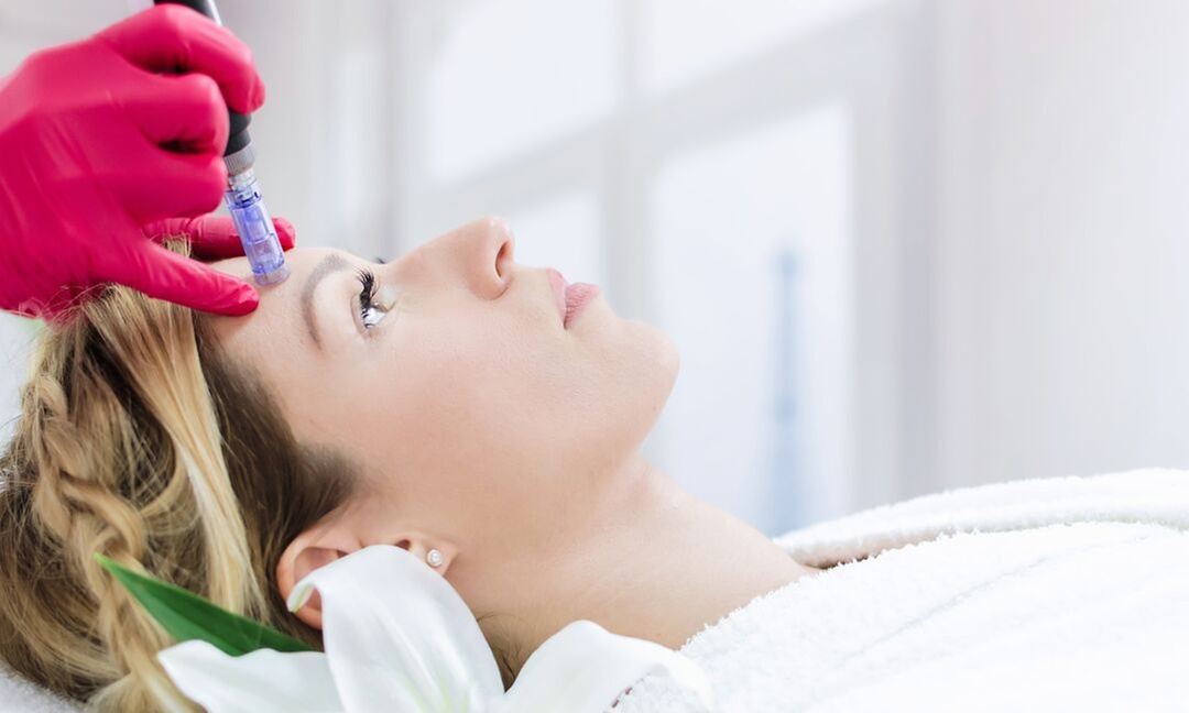 Up to 55% Off on Micro-Needling at Permanent Makeup Plus