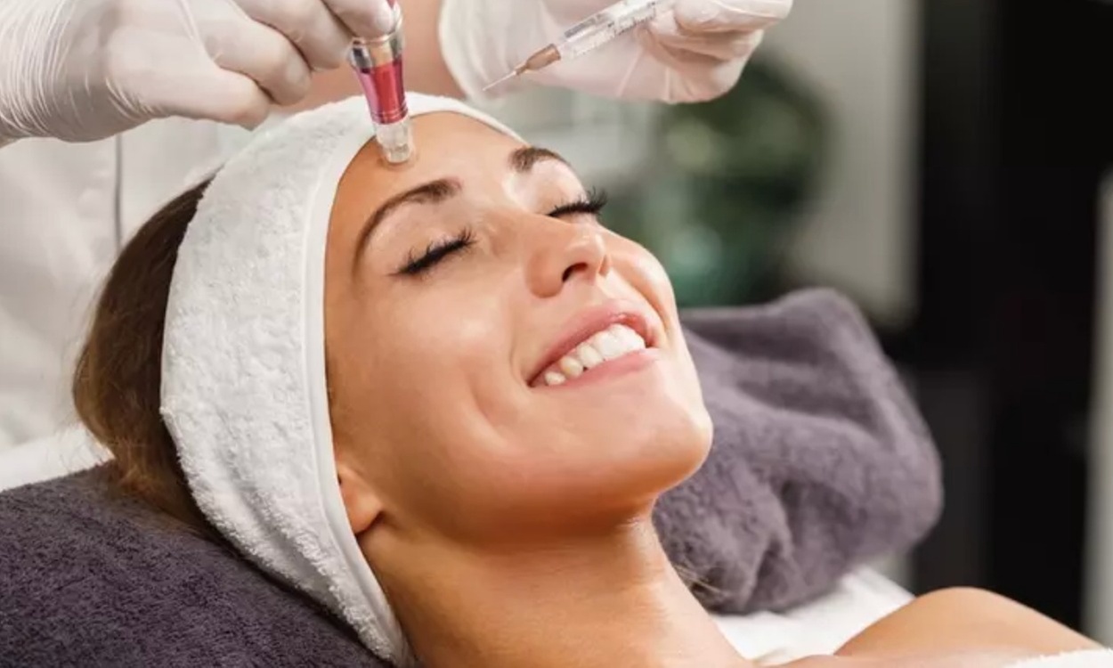 Up to 30% Off on Microneedling - Stem Cell Serum at LAS Clinic