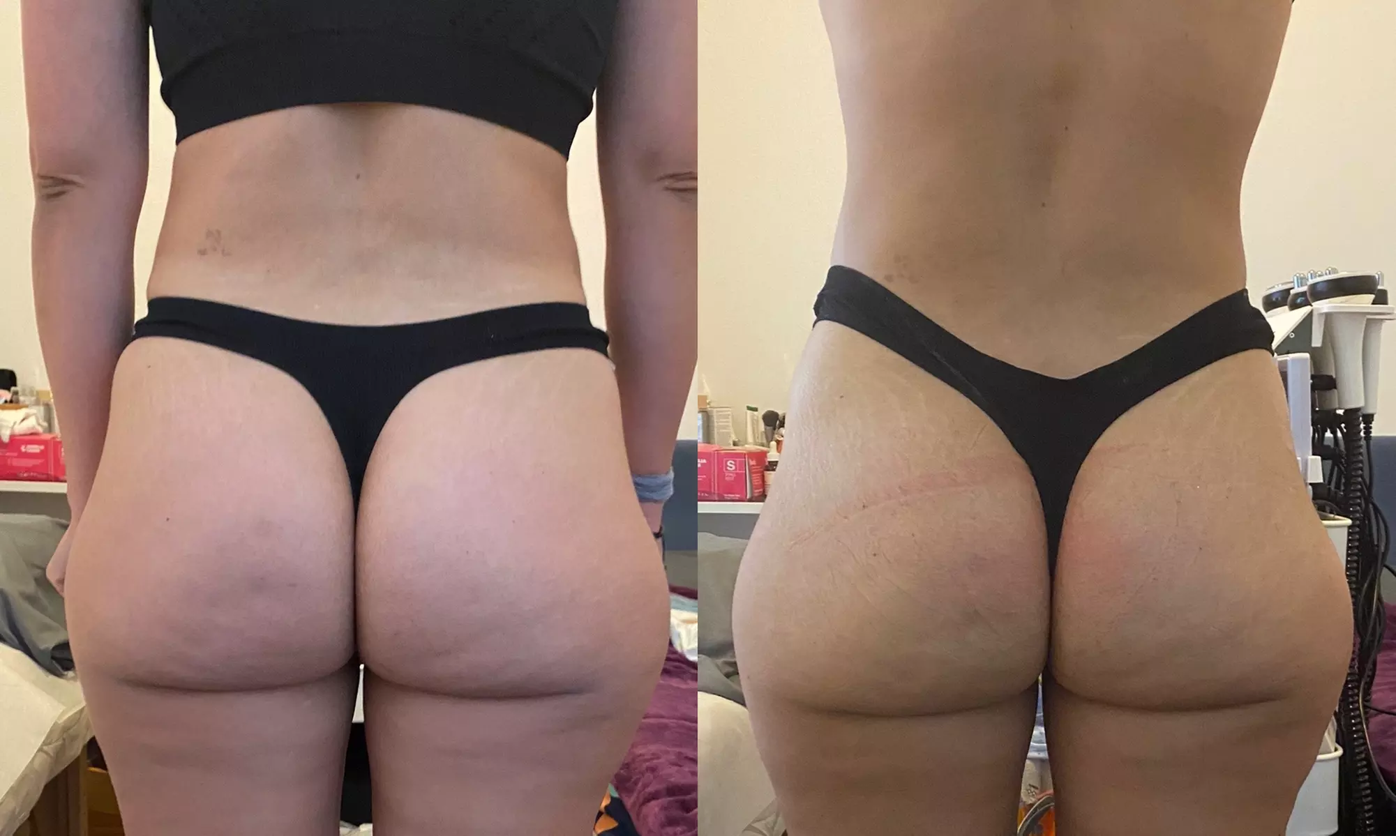 Up to 55% Off on  at Body Sculpt Studios - Second Medium