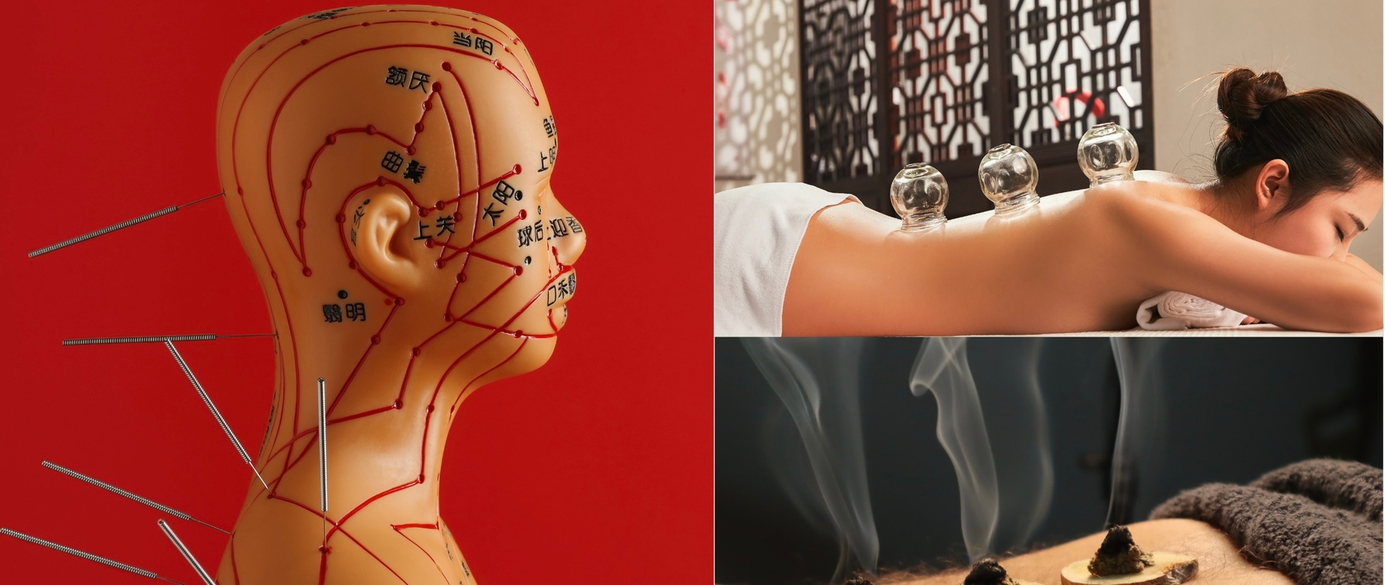 Up to 62% Off on Acupuncture