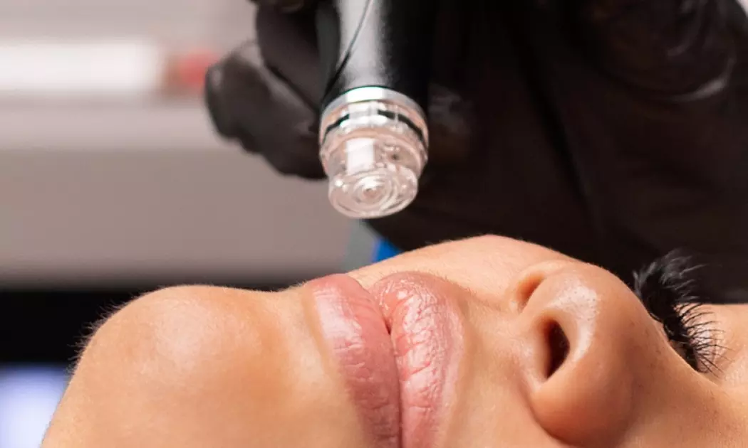 Up to 61% Off on HydraFacial with LED at Alinea Medical Spa - Second Medium