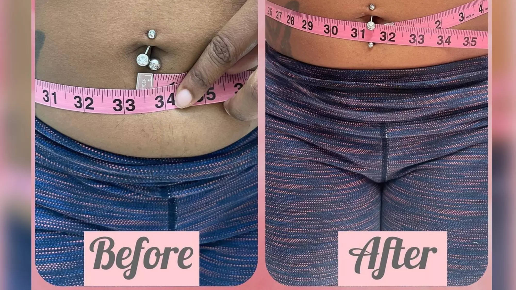 Shape & Tone Your Body with Cavitation and Vacuum Therapy Sessions