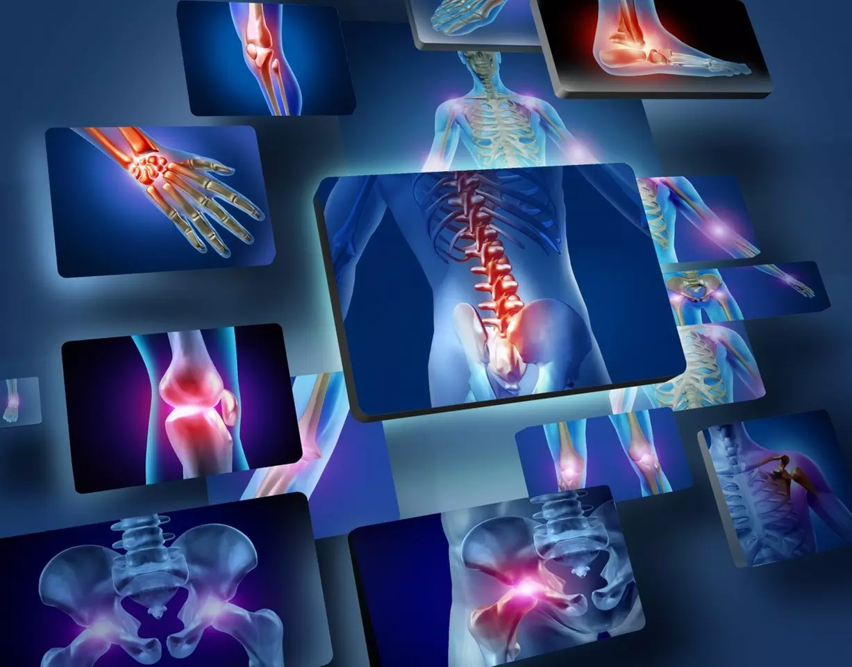 Up to 51% Off on Cryotherapy at UK Aesthetics Lounge