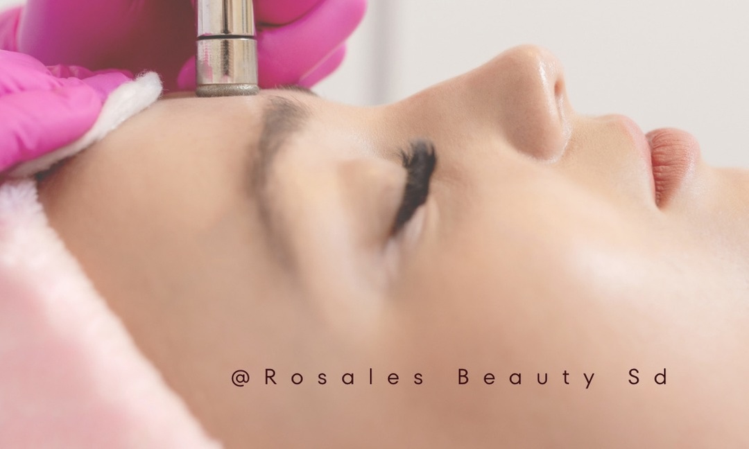 Up to 35% Off on Microdermabrasion at Rosales Beauty SD LLC