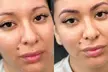 Up to 50% Off on Microblading at SkinFit by Anneliese - Second Medium