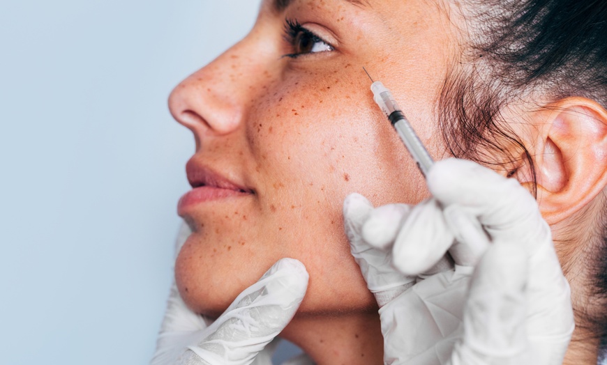 Image 3: Experience Unlimited Xeomin Units for Full Face at June Skin