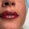 Image 1: One Micropigmentation Full Lips /Two Lips Full Color Micropigmentation