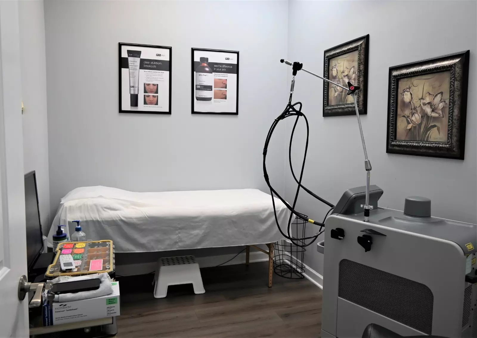 One Microneedling Session for Cellulite/Stretch Marks