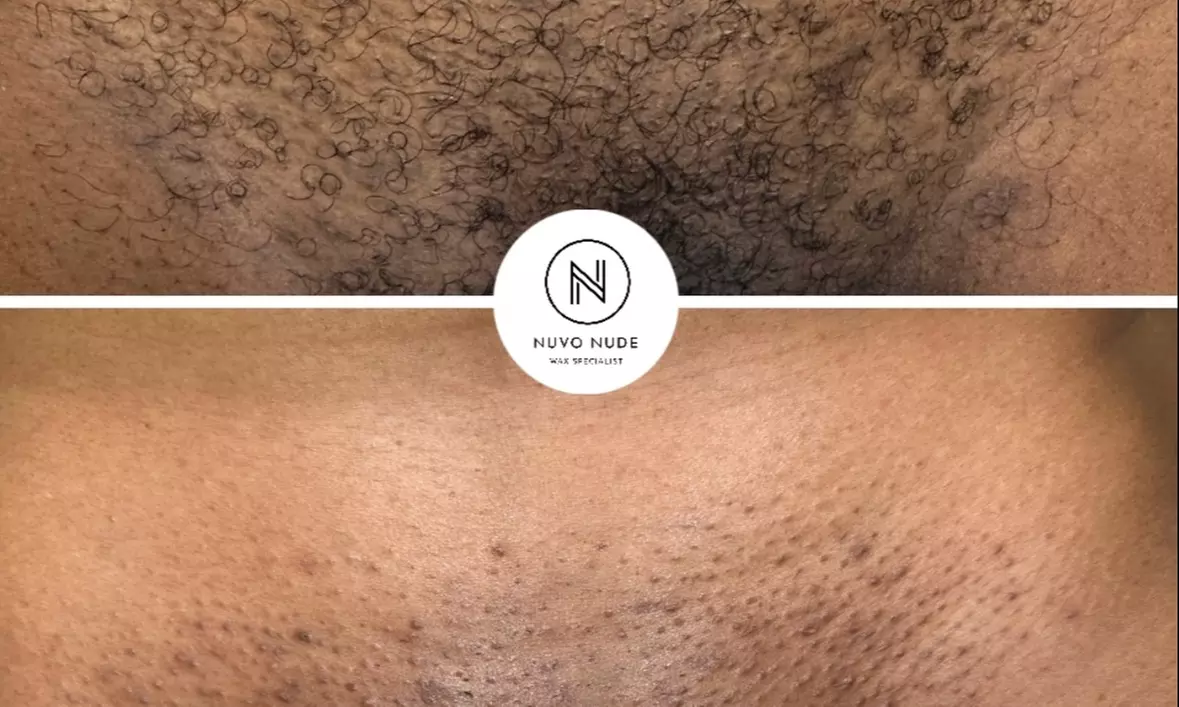 Experience silky smooth skin with our professional waxing services