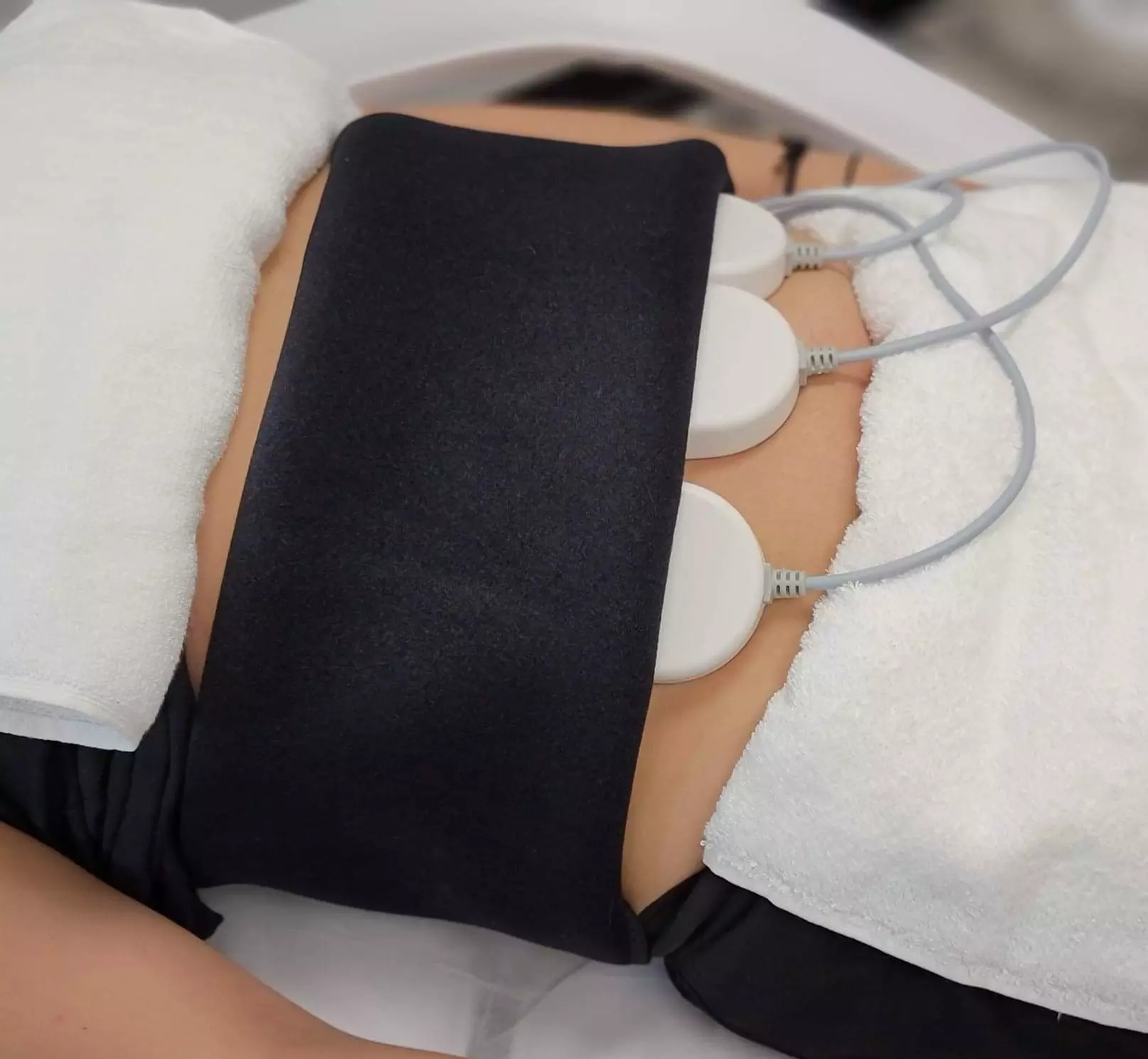 Refresh Your Skin: 1 Laser Skin Resurfacing or 3 Radio-Frequency Skin-Tightening Treatments ( Up to 90% Off ) - Primary Image