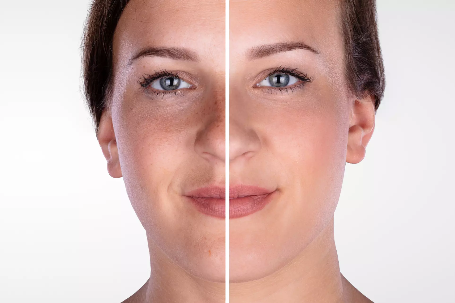 Experience Smooth Skin with Microdermabrasion Treatment Options