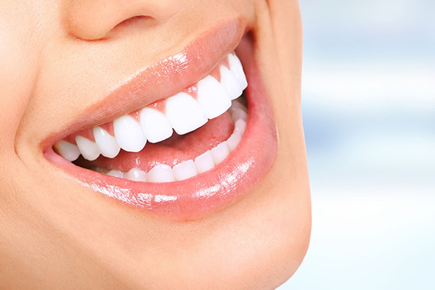 Sun Kissed Glo And Beauty Bar's Teeth Whitening: Three Tailored Options for a Brighter Smile up to 39% Off