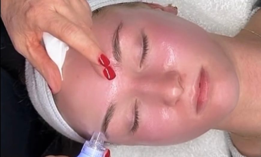 Image 1: HydraFacial Treatment with Dermaplaning Option for Glowing Skin
