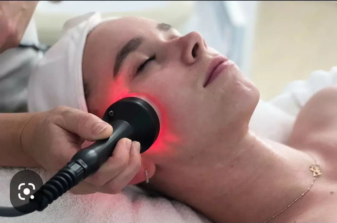 Explore Transdermal Aesthetics' RF and Micro Current Treatments, offering up to 64% off for a revitalizing experience