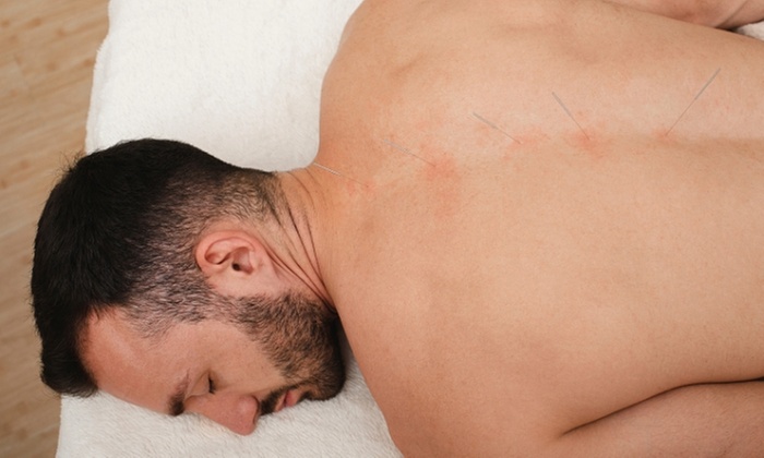 Learn Acupuncture in Medicine Online Course with Training Express