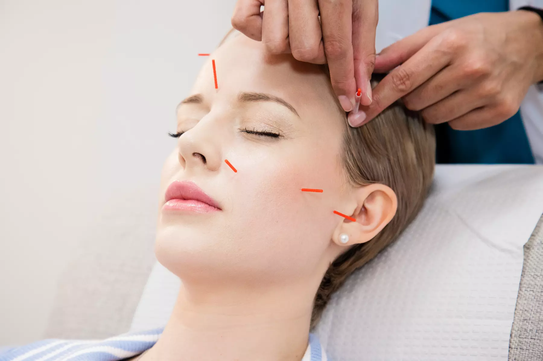 Experience Tranquil Acupuncture and Aromatherapy Options