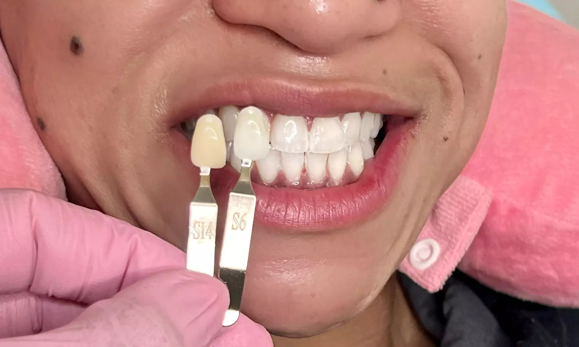 Up to 16% Off on Teeth Whitening - In-Office - Non-Branded at Marie London Spa - Primary Image