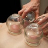 Image 6: Up to 30% Off Acupuncture - Tailored Sessions with Award-Winning L.Ac