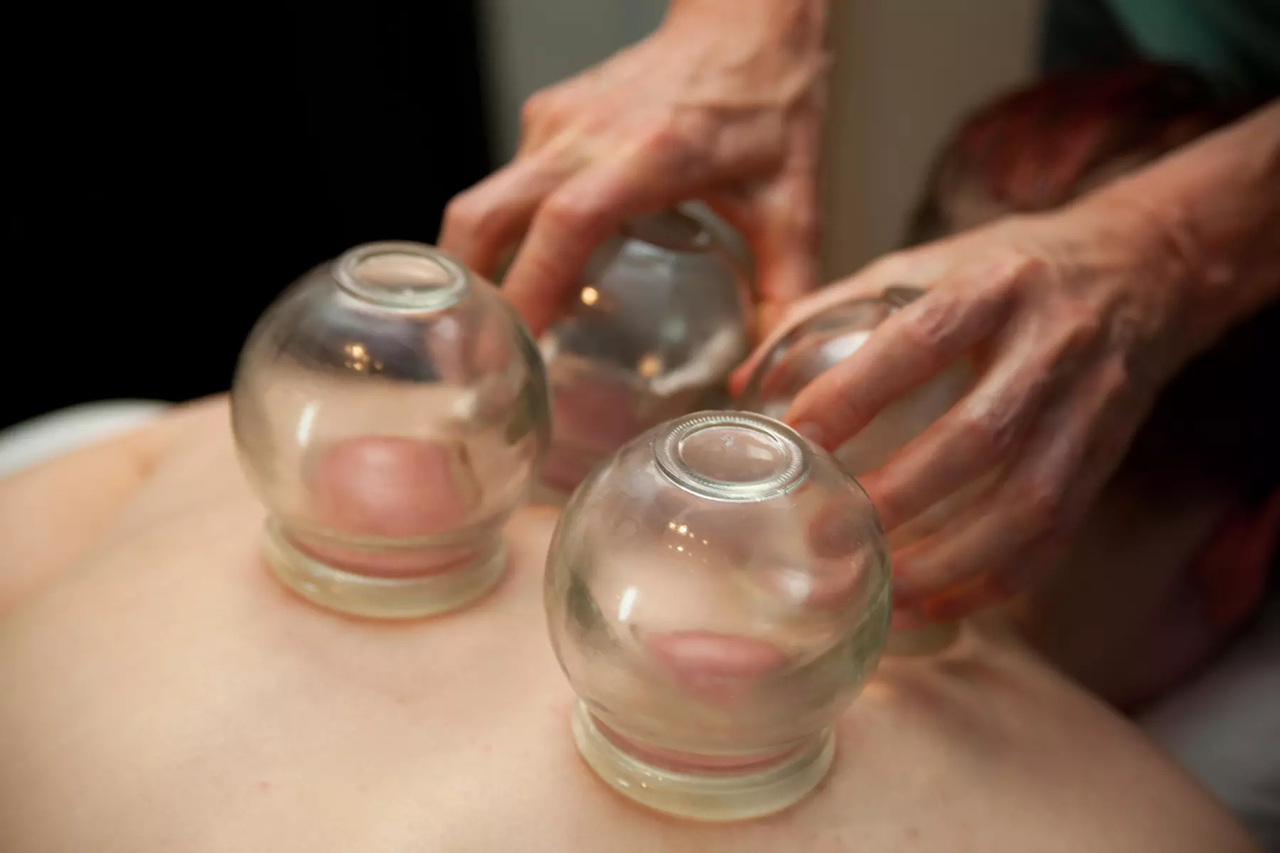 Up to 30% Off Acupuncture - Tailored Sessions with Award-Winning L.Ac