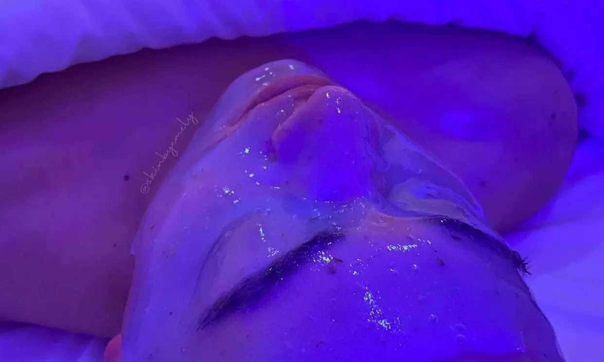 Up to 40% Off on Facial at Skin by Emely