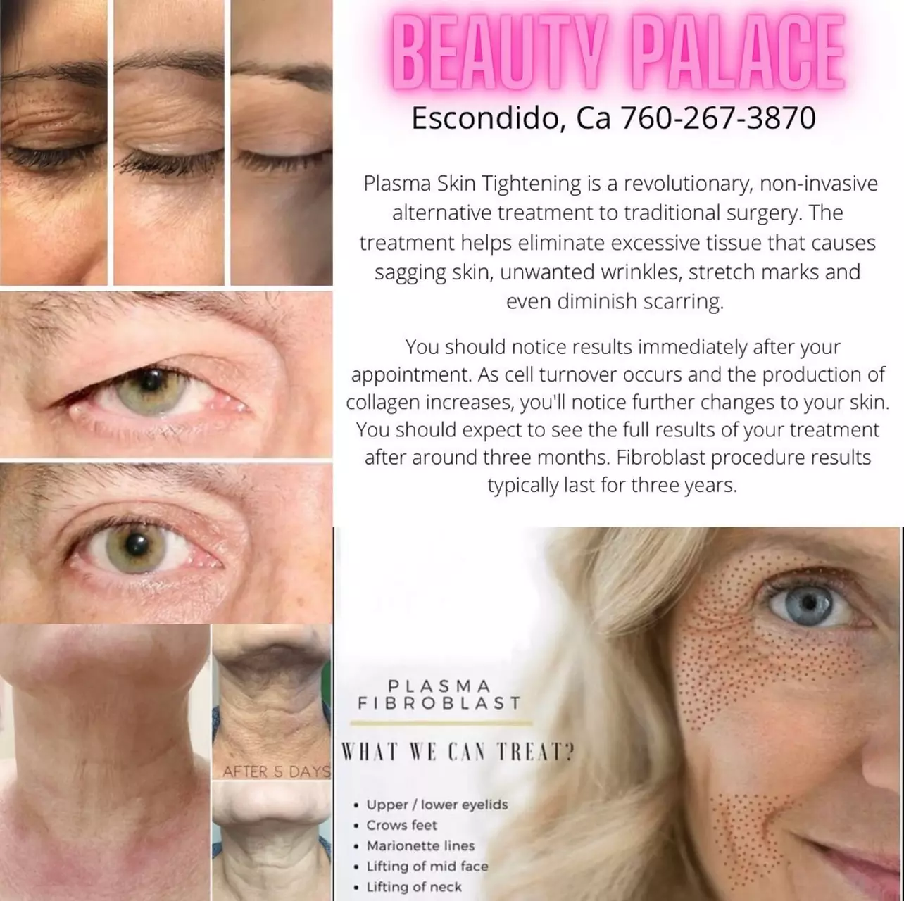Experience Beauty By Cayla's rejuvenating facelifts, including neck lifts, eyes, and full face with up to 50% off. - Primary Image