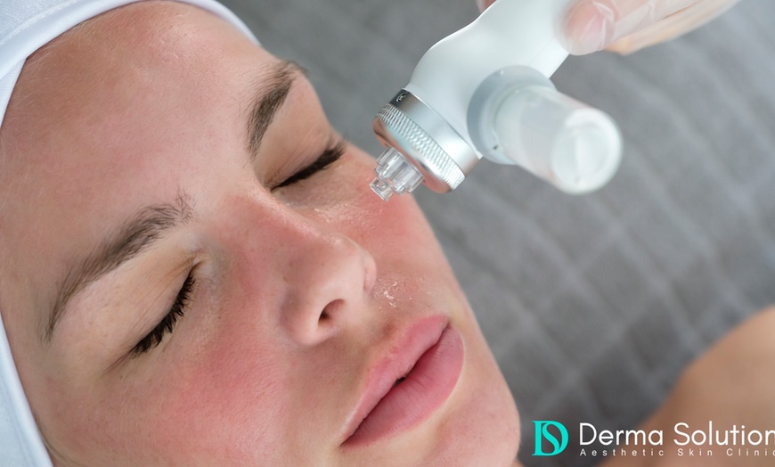 Image 2: Dive into Radiance: Unleash Your Glow with Hydrafacial - Derma Builder