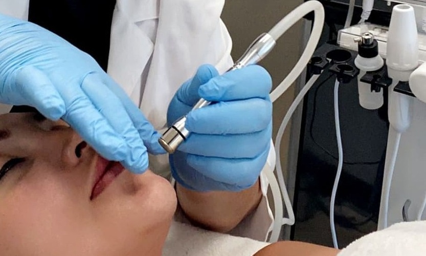 Up to 39% Off on Microdermabrasion at Radiant and Young Skin