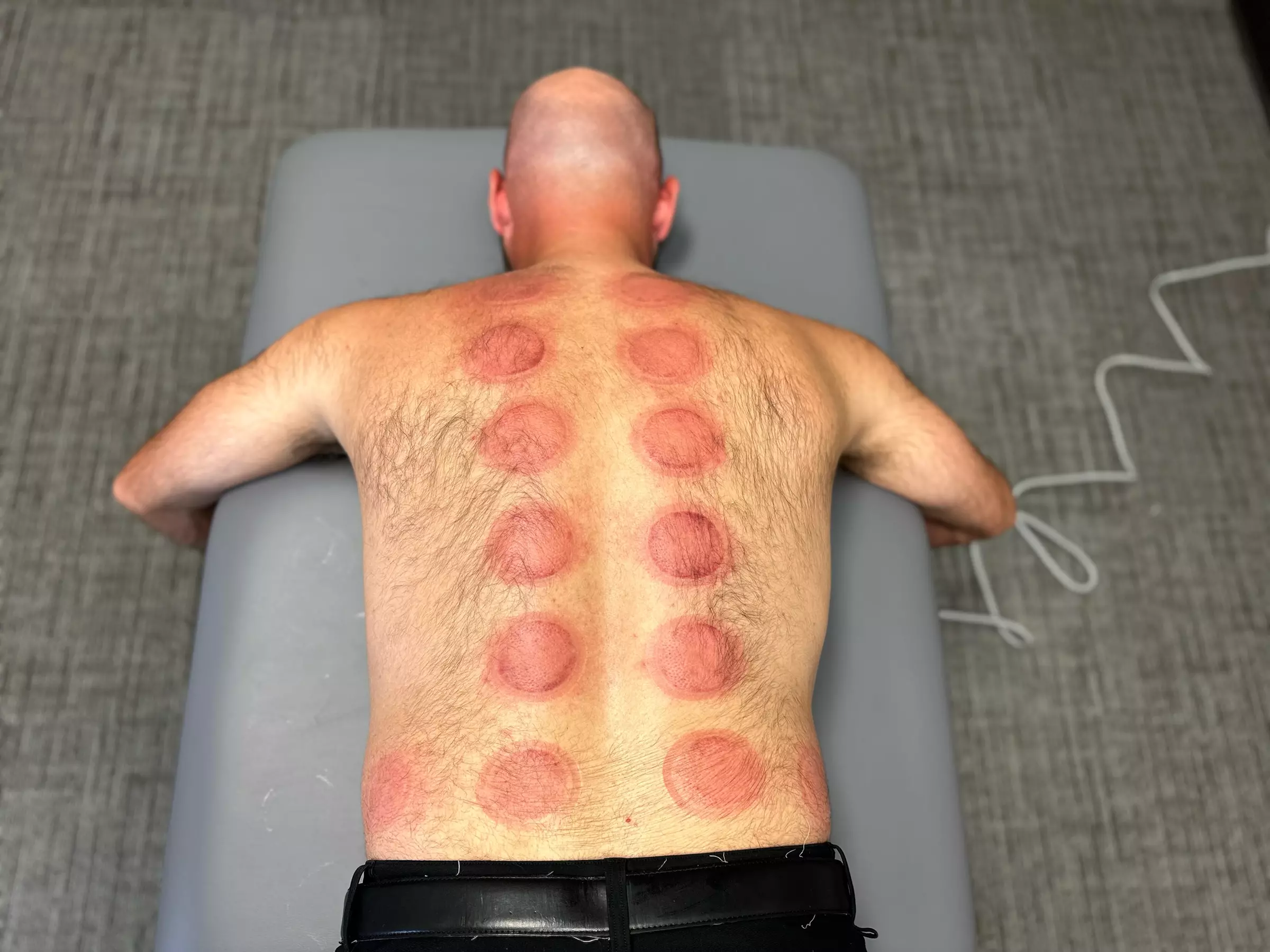 Up to 40% Off on Physiotherapist at Elite Physical Therapy and Performance - Second Medium